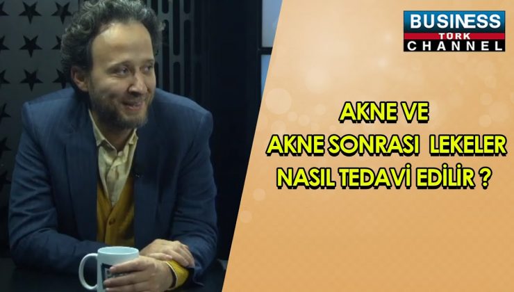 AKNE VE AKNE SONRASI LEKELER NASIL TEDAVİ EDİLİR ? ENİS ERTÜRKLER ANLATIYOR..